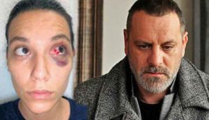 Ozan-Güven’den-şiddet-gören-Deniz-Bulutsuz’un-adli-tıp-raporu-ortaya-çıktı