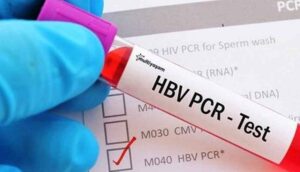 PCR-testi-fiyatı-ne-kadar--PCR-testi-fiyat-2020