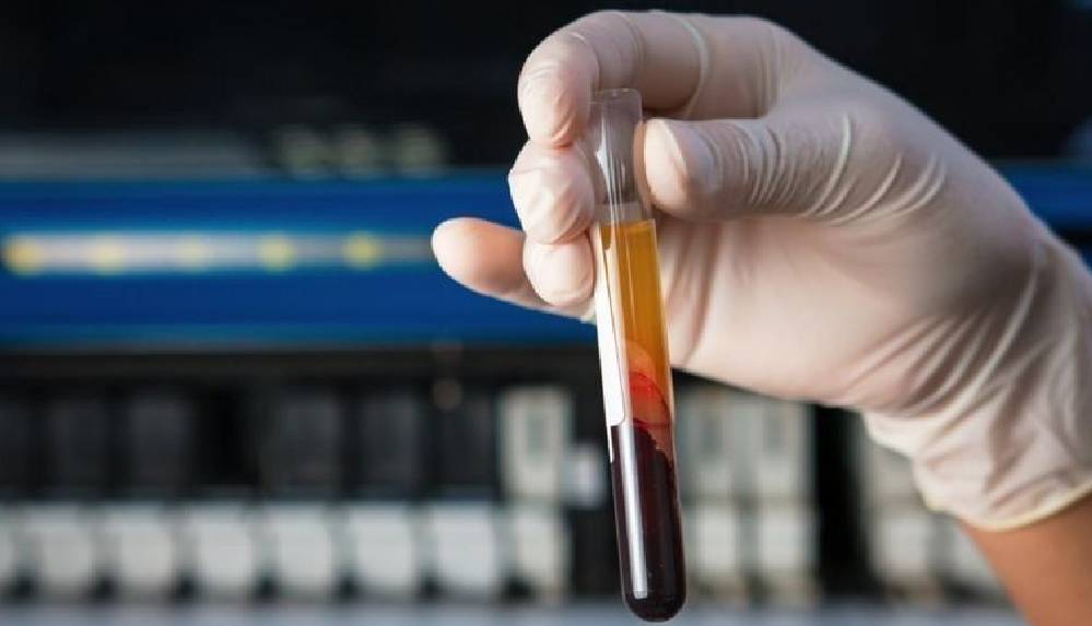 İngiltere'de 50'den fazla kanser türünü erken tespit etmesi umulan kan testi denenecek