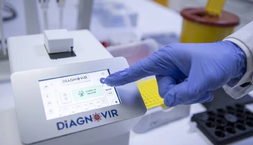 Türk bilim insanları corona virüs teşhisini 10 saniyeye düşüren tanı sistemi geliştirdi