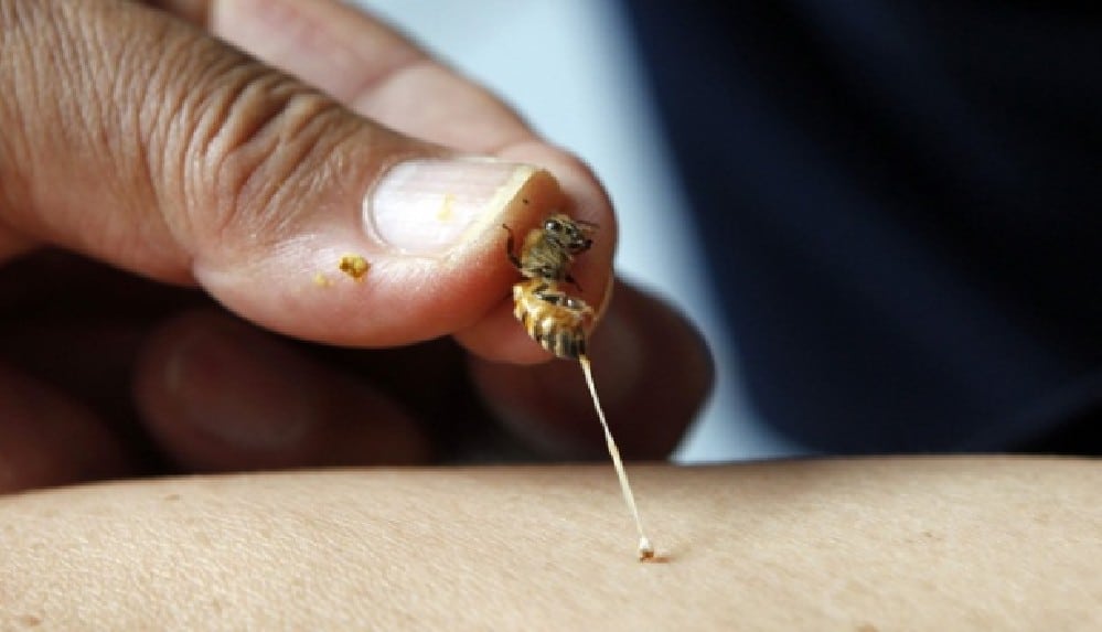 Corona'ya iyi geliyor diyerek bal arılarına kendilerini ısırtıyorlar