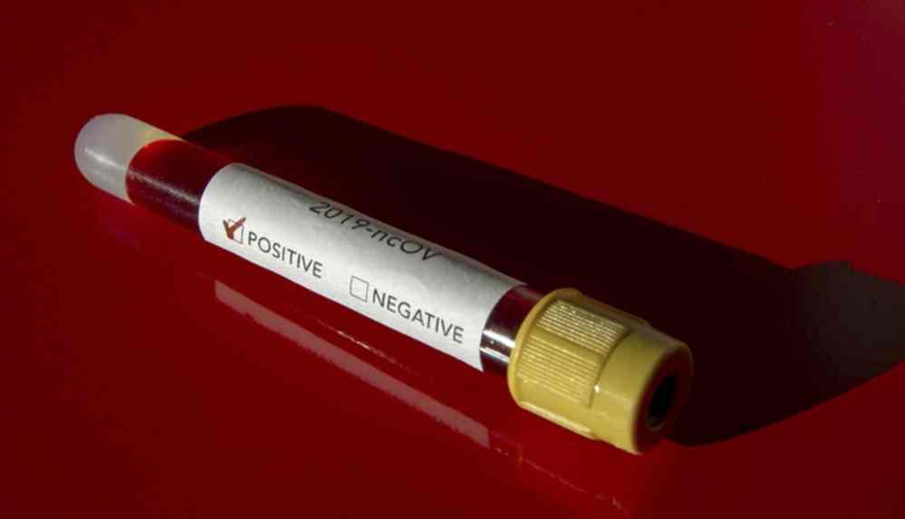 Kovid-19'dan korunmak için 'kutsal iksir' içen Sri Lankalı Sağlık Bakanı'nın testi pozitif çıktı