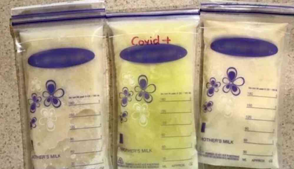 Corona virüsüne yakalanan annenin sütü açık yeşil oldu