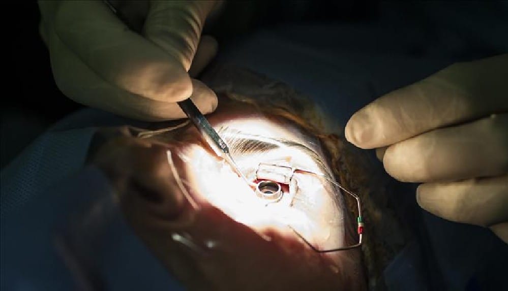 Hatalı ameliyatla gözünü kaybeden vatandaşın tazminat davası_ '100 bin TL çok, 10 bin TL yeter