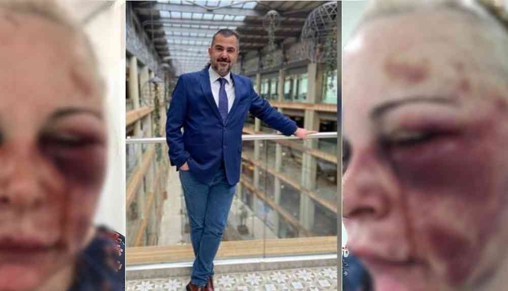 İki gün boyunca işkence_ Yaşadığı dehşeti anlattı