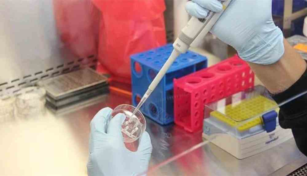 Kovid-19'un neden olduğu komplikasyonlar sonucu ölen hastaların çoğunun kalbinde virüse rastlandı