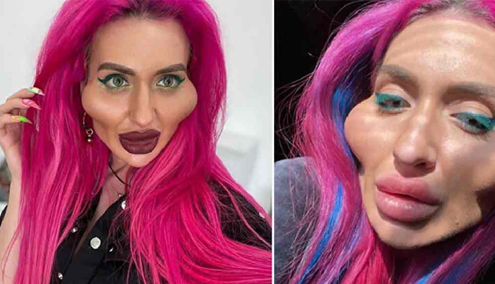 Ukraynalı model Pokreshchuk dünyanın en büyük elmacık kemiklerine sahip