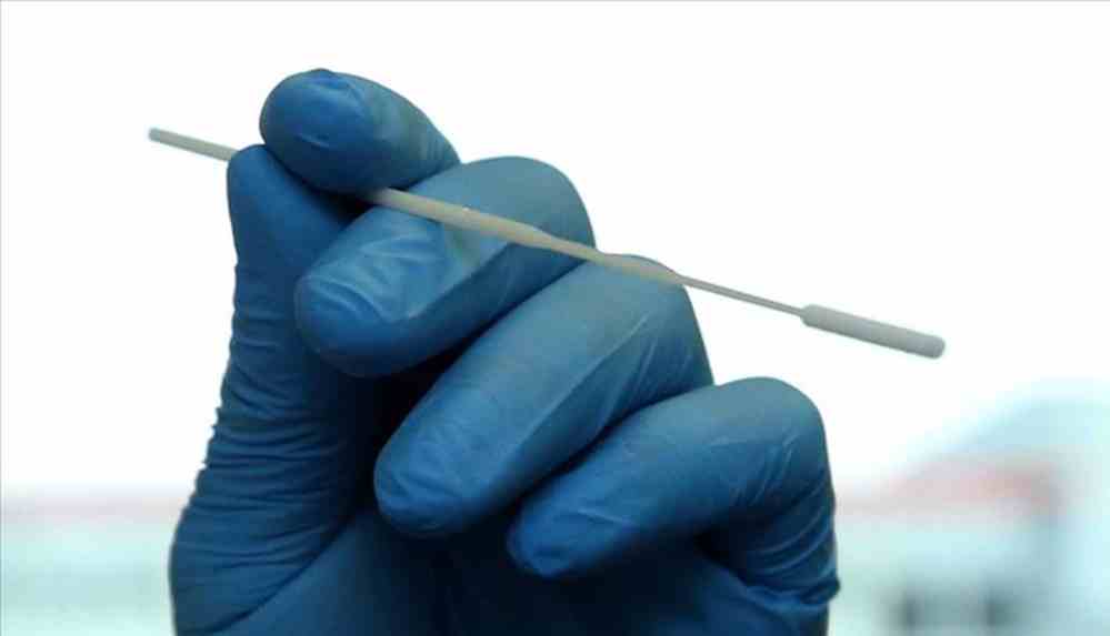 Geliştirilen Kovid-19 testi 1 saniyede sonuç veriyor