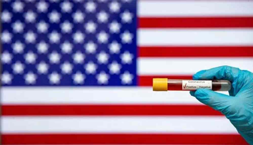 Kovid-19 bilgileri sil baştan_ Virüsün Wuhan'dan önce ABD'de görüldüğüne dair yeni bulgular elde edildi