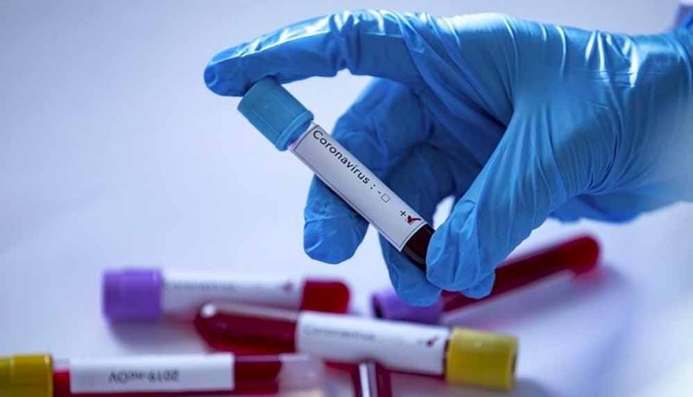 Tokyo-Olimpiyatları'nda-Covid-19'a-yakalananların-sayısı-322'ye-çıktı