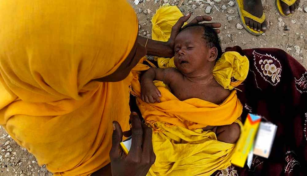 Dünya-genelinde-35-milyon-insan-açlıktan-ölüyor-veya-ölmek-üzere!