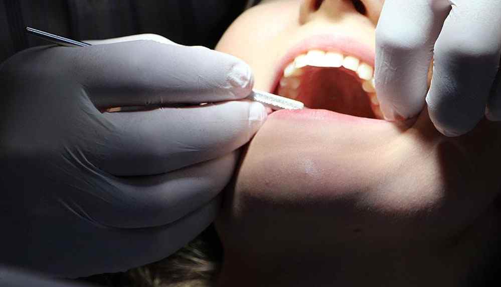 İngiltere'de şimdi de 'diş hekimi' kıtlığı! İnsanlar dişlerini kendileri çekmeye başladı