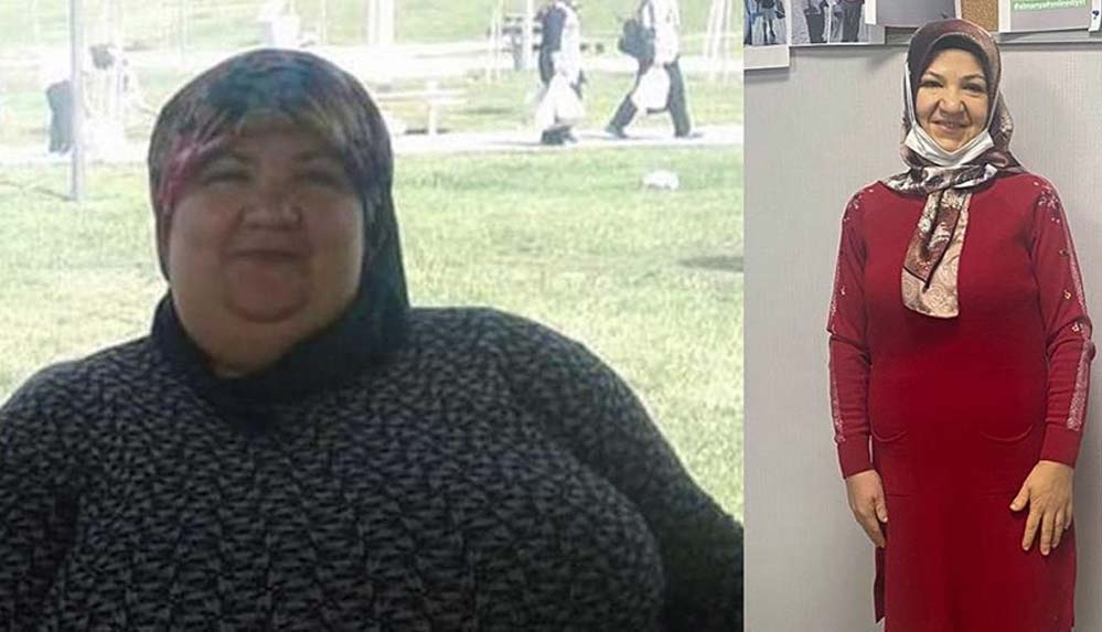 Sağlikli-yaşam-için-azmetti-95-kilo-verdi-1