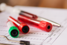 site foto ölcusu (56)