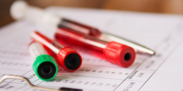 site foto ölcusu (56)