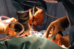 site foto ölcusu - 2023-03-26T233603.611