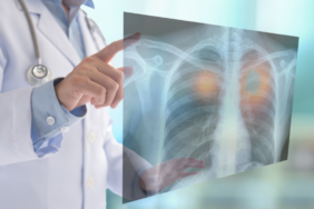 site foto ölcusu - 2023-06-27T195005.523