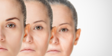 site foto ölcusu (10)