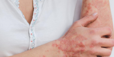 site foto ölcusu - 2023-07-24T145708.746