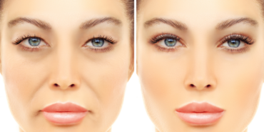 site foto ölcusu - 2023-07-28T133814.799