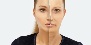 site foto ölcusu (80)