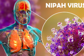 site foto ölcusu - 2023-09-16T130730.204