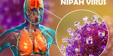 site foto ölcusu - 2023-09-16T130730.204