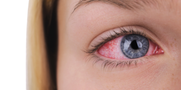 site foto ölcusu - 2023-09-29T204528.051