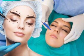 site foto ölcusu (61)