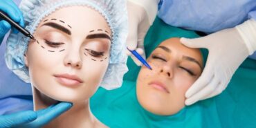 site foto ölcusu (61)