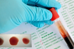 site foto ölcusu - 2024-09-20T232405.951