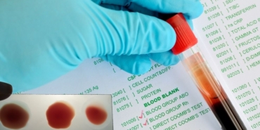 site foto ölcusu - 2024-09-20T232405.951