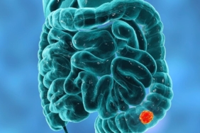 site foto ölcusu - 2024-09-25T222515.400