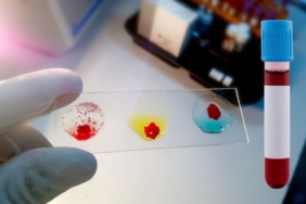 site foto ölcusu - 2024-11-13T131755.778