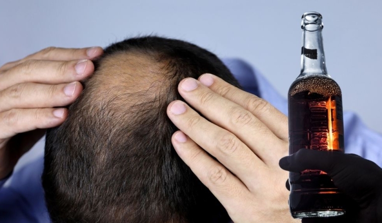 Bilim insanları duyurdu: Erkeklerde kelleşmenin nedenlerinden biriymiş