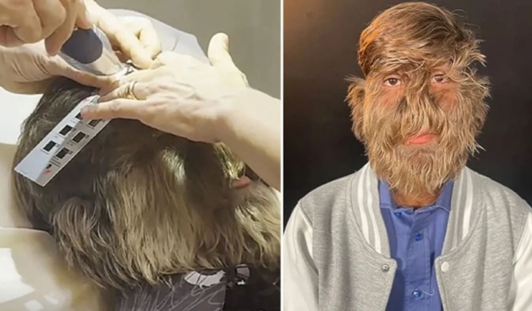 Kıllarının arasında büyük bir gizem taşıyor: Duyan yaşına inanamıyor