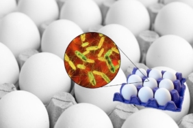 site foto ölcusu (11)