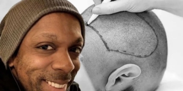 site foto ölcusu (3)