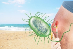 site foto ölcusu (6)