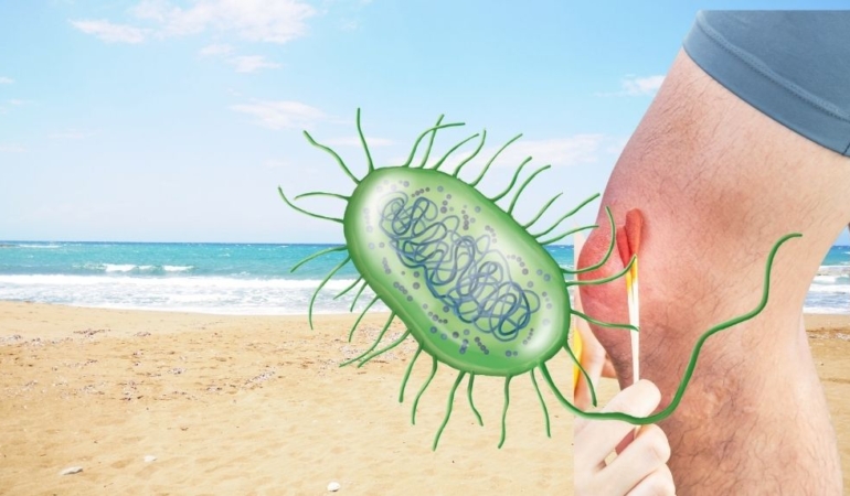 Plajlarda tehlike büyüyor: ‘Et yiyen bakteri’ hızla yayılıyor